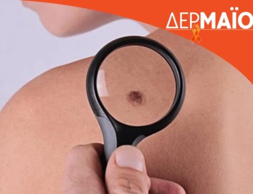 ΔΕΡΜΑΪΟΣ: Μήνας πρόληψης και ενημέρωσης για τον καρκίνο του δέρματος