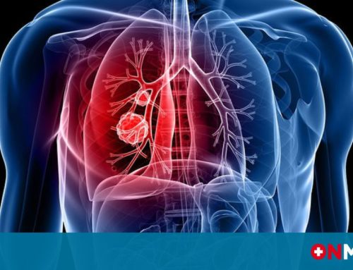 ΥΠΕΝΘΥΜΙΣΗ: Εκδήλωση  για τον Καρκίνο του Πνεύμονα και δωρεάν εξέταση σπιρομέτρησης από το   ΚΕΠ Υγείας Δήμου Κορινθίων